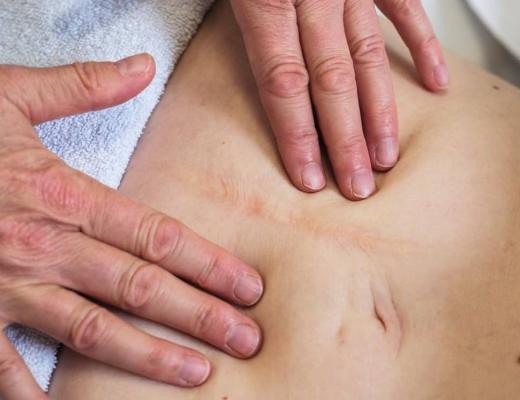 A pair of hands massaging a scar on a woman's stomach